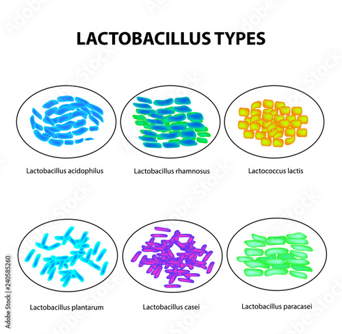 Types of lactobacilli. Lactobacillus. Good intestinal microflora. Infographics. set. Vector illustration on isolated background.
