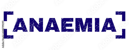 ANAEMIA label seal print with grunge texture. Text tag is placed between corners. Blue vector rubber print of ANAEMIA with grunge texture.