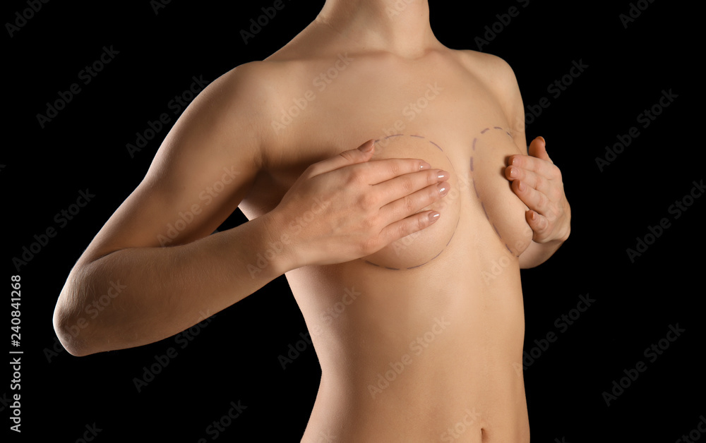 Young woman with marks on breast for cosmetic surgery operation against dark background Young woman with marks on breast for cosmetic surgery operation against dark background
