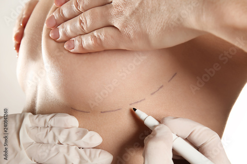 Doctor drawing marks on fem...