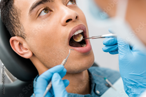 Canvas-taulu close up of african american man with open mouth during examination in dental cl