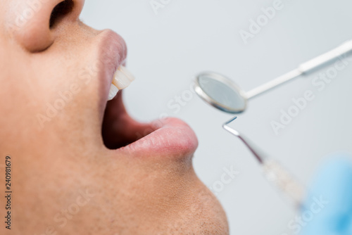 cropped view of african american man with open mouth during checkup in dental clinic