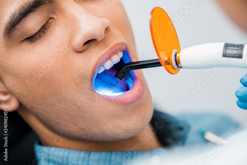Fotografi close up of african american man during whitening procedure
