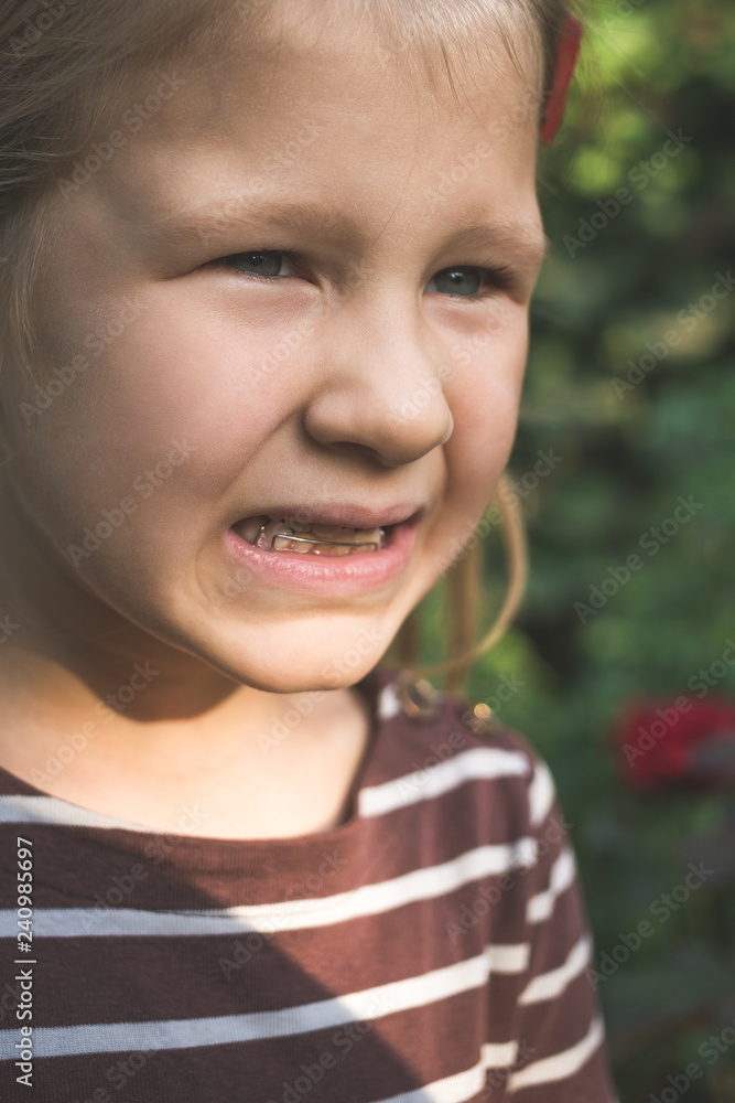 Child with a dental orthodontic device and without one tooth Child with a dental orthodontic device and without one tooth