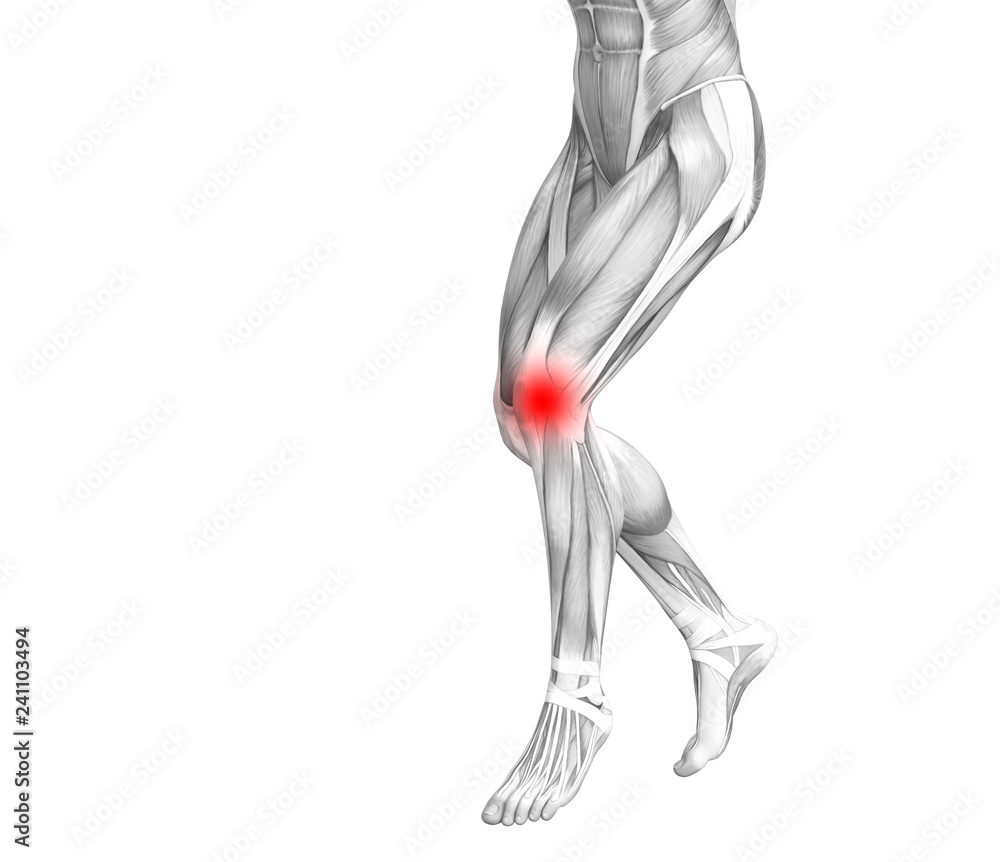 Conceptual knee human anatomy with red hot spot inflammation or articular joint pain for leg health care therapy or sport muscle concepts. 3D illustration man arthritis or bone osteoporosis disease Conceptual knee human anatomy with red hot spot inflammation or articular joint pain for leg health care therapy or sport muscle concepts. 3D illustration man arthritis or bone osteoporosis disease
