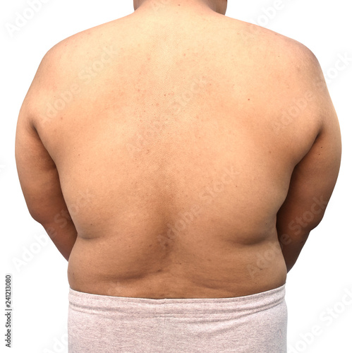 fat body of man on white background
