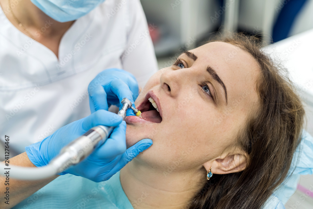 Dentist polishing patient's teeth after whitening procedure Dentist polishing patient's teeth after whitening procedure