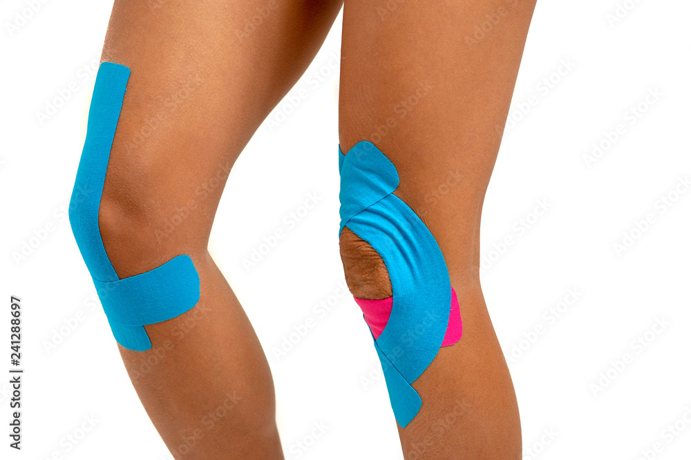 Female knee with physio tape on white background Female knee with physio tape on white background