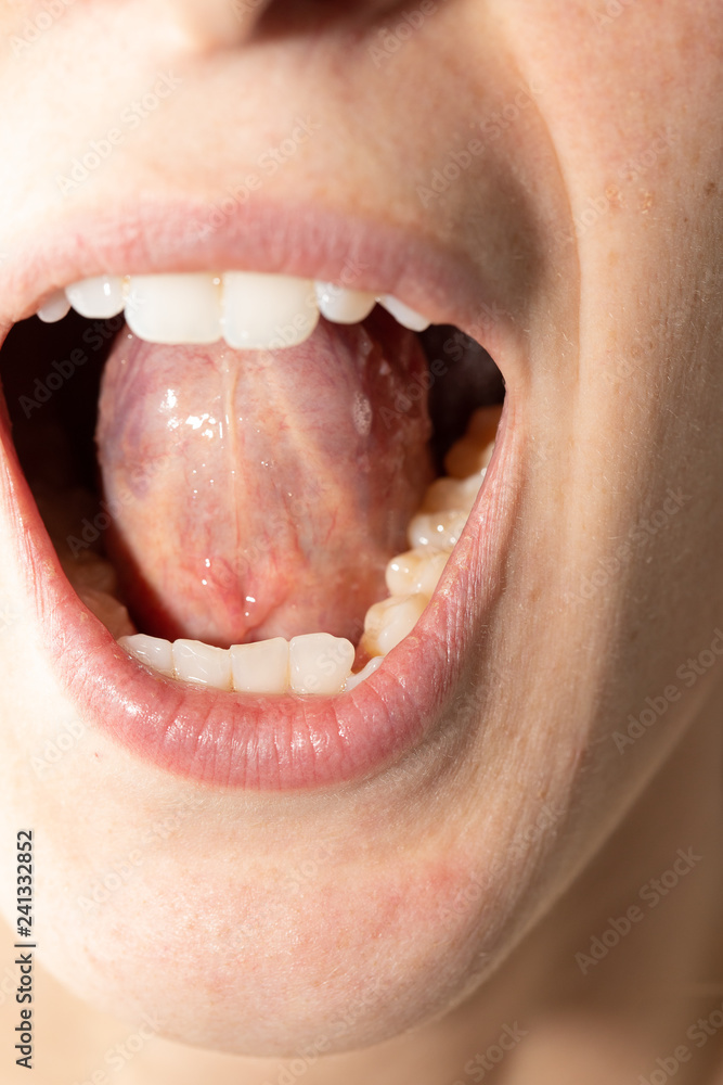 Obraz premium Closeup of woman's open mouth
