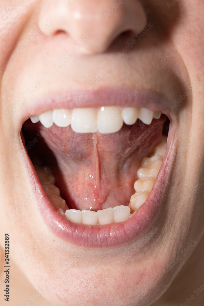 Closeup of woman's open mouth