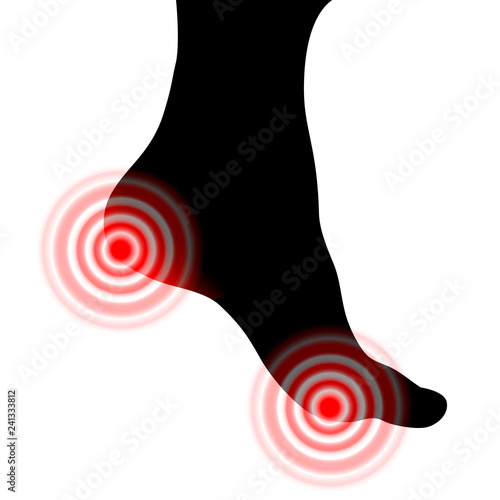 Silhouette of painful sore red Human foot. Foot health concept. Vector object isolated on white background.
