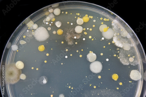 Close-up of bacteria and mold growing in a Petri dish. Microorganisms were isolated from a computer keyboard by wiping the keyboard with a cotton swab and then inoculating the agar in the Petri dish