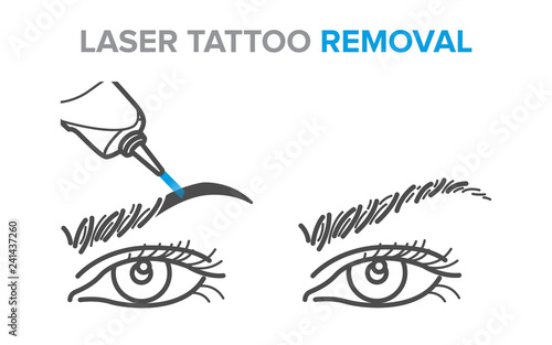 Eyebrow removal procedure, laser tattoo removal icons, microblading
