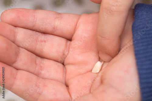 The child holds a fallen tooth on the palm of his hand. Milk tooth on the palm. First tooth lost