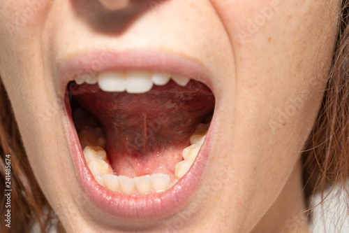 Foto Closeup of woman's open mouth