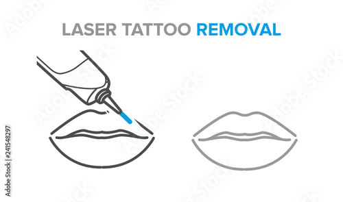 Permanent makeup removal, microblading, laser tattoo removal