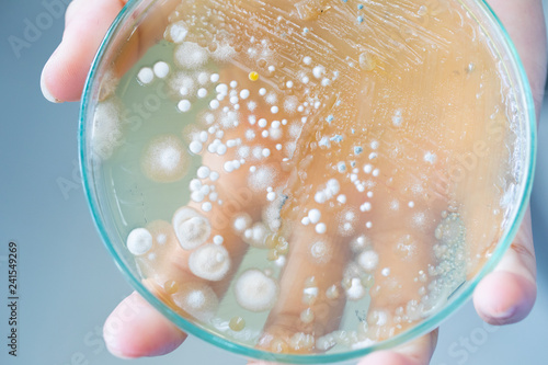 Colony characteristic of Actinomyces, Bacteria, yeast and Mold on selective media from soil samples for study in laboratory microbiology. photo