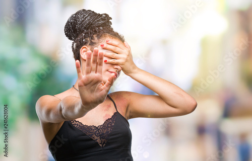 Εκτύπωση καμβά Young braided hair african american with pigmentation blemish birth mark over isolated background covering eyes with hands and doing stop gesture with sad and fear expression