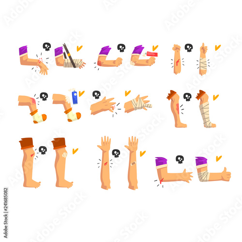 Damaged body parts set, injuries and fractures of the arms and legs, first aid and treatment vector Illustration on a white background