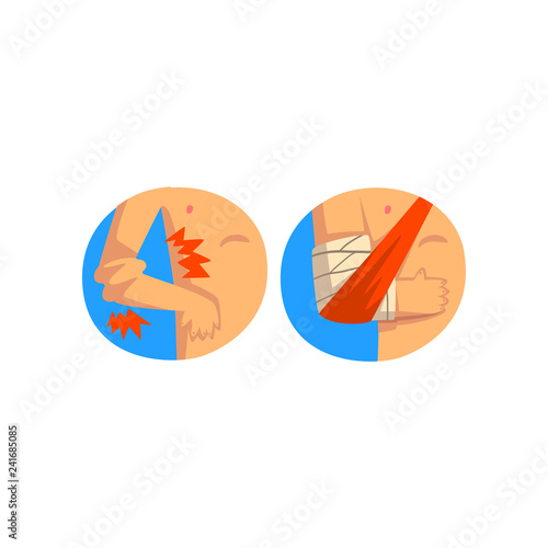 Elbow injury, medical bandage wrapped around hurt human hand, sprain and first aid vector Illustration on a white background