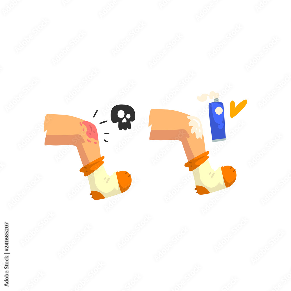 Knee injury, first aid and treatment vector Illustration on a white background