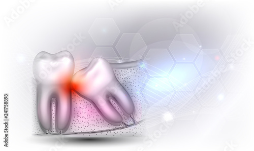 Wisdom tooth eruption problems illustrated anatomy on a beautiful light grey glowing background