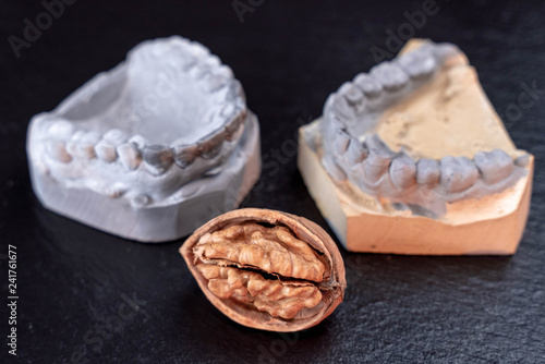 Molds of the jaw and walnuts