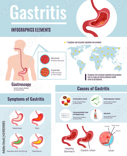 Gastritis Infographic Poster 