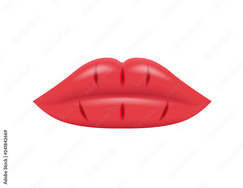 cracked lips / dry lips / organ and anatomy vector cracked lips / dry lips / organ and anatomy vector
