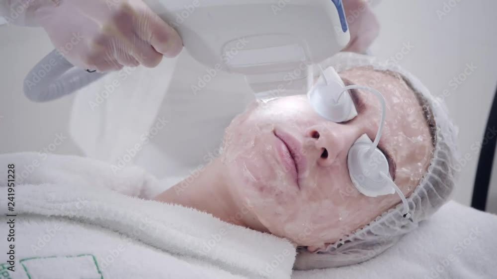Anti acne phototherapy with professional equipment. Beautiful woman in beauty salon during photo rejuvenation procedure. Laser face skin treatment at cosmetic clinic. Hardware cosmetology Anti acne phototherapy with professional equipment. Beautiful woman in beauty salon during photo rejuvenation procedure. Laser face skin treatment at cosmetic clinic. Hardware cosmetology