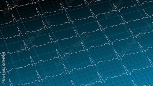 Cardiogram on gradient dark blue background 3D illustration