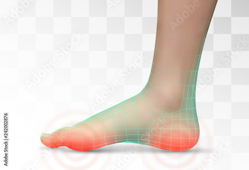 vector human foot.red spots of pain. ready element for medicine and orthopedics
