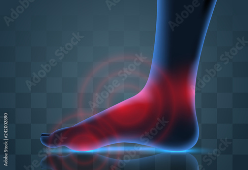 vector human foot. blue contour and red spots of pain. ready element for medicine and orthopedics