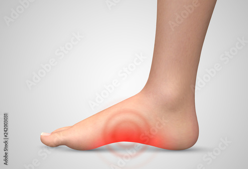 vector human foot.red spots of pain. ready element for medicine and orthopedics