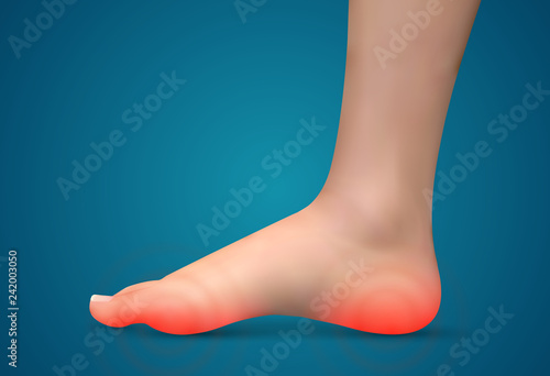 vector human foot.red spots of pain. ready element for medicine and orthopedics