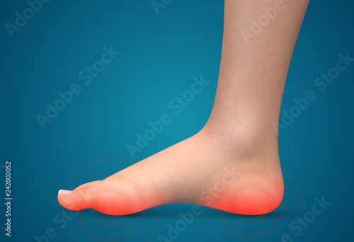 vector human foot.red spots of pain. ready element for medicine and orthopedics