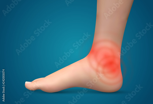 vector human foot.red spots of pain. ready element for medicine and orthopedics