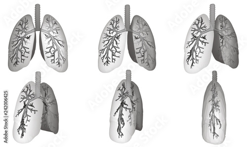 Vector set 3D lungs and bronchus. Isolated on white background. Element for medical design.