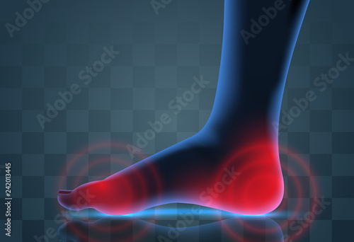 vector human foot. blue contour and red spots of pain. ready element for medicine and orthopedics