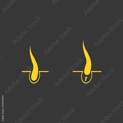 Normal follicle and types of hair removal with help of razor, depilation cream, wax, sugaring vector illustration