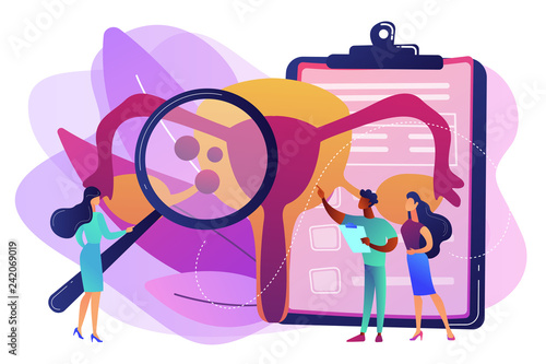 Doctors examine uterus with magnifier to treat endometriosis. Endometriosis, endometrium dysfunctionality, endometriosis treatment concept. Bright vibrant violet vector isolated illustration
