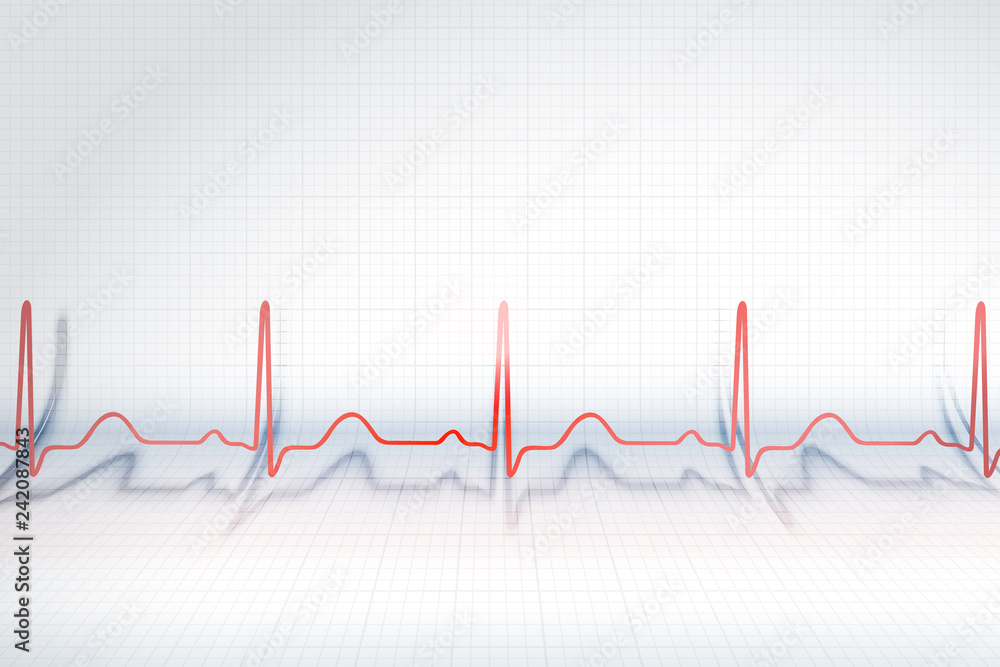 Red line of ECG chart Red line of ECG chart