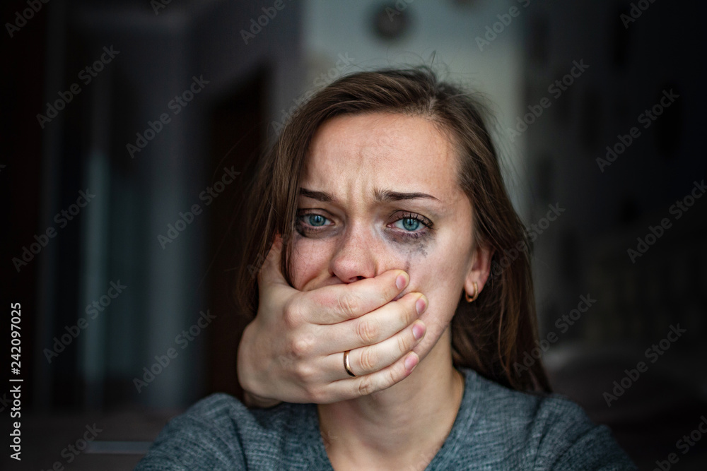 Portrait of a crying woman after beating by her husband. Female violence concept. Help for women suffering from domestic, woman violence. Social and life problems Portrait of a crying woman after beating by her husband. Female violence concept. Help for women suffering from domestic, woman violence. Social and life problems
