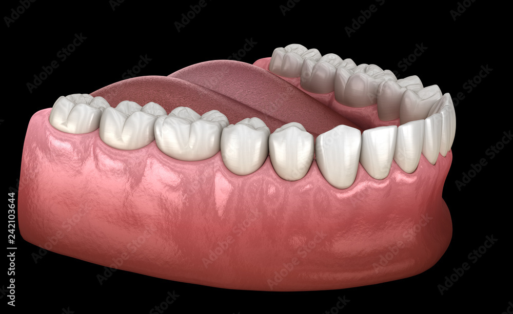 Mandibular human gum and teeth. Medically accurate tooth 3D illustration Mandibular human gum and teeth. Medically accurate tooth 3D illustration