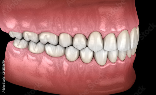 Fototapeta Naklejka Na Ścianę i Meble -  Healthy human teeth with normal occlusion, side view. Medically accurate tooth 3D illustration