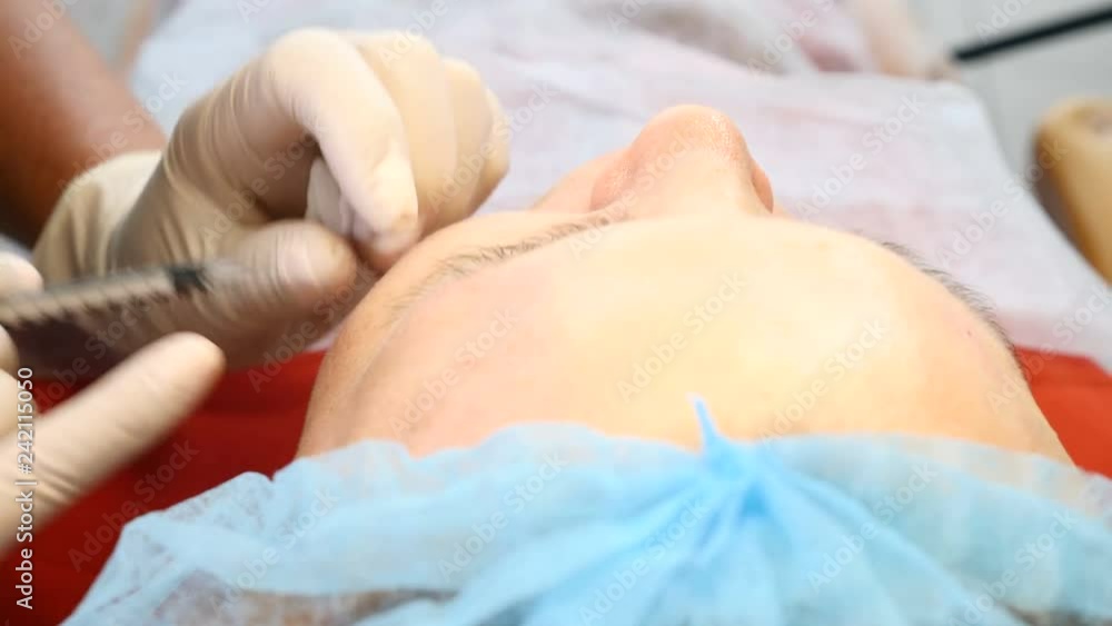 Top view on woman getting facial beauty procedure in a healthcare clinic. Closeup shot of beautician hand with a syringe. Face lifting procedure. 4k Top view on woman getting facial beauty procedure in a healthcare clinic. Closeup shot of beautician hand with a syringe. Face lifting procedure. 4k
