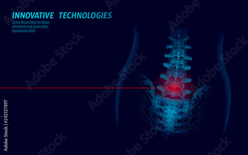 Laser physiotherapy human spine. Pain area surgery operation modern medicine technology low poly triangles 3D render female back hernia vector illustration