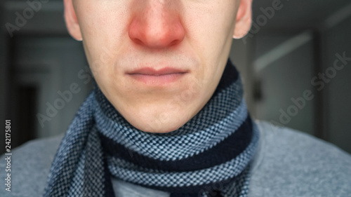 Vászonkép Unrecognizable sick guy in warm scarf with a red nose