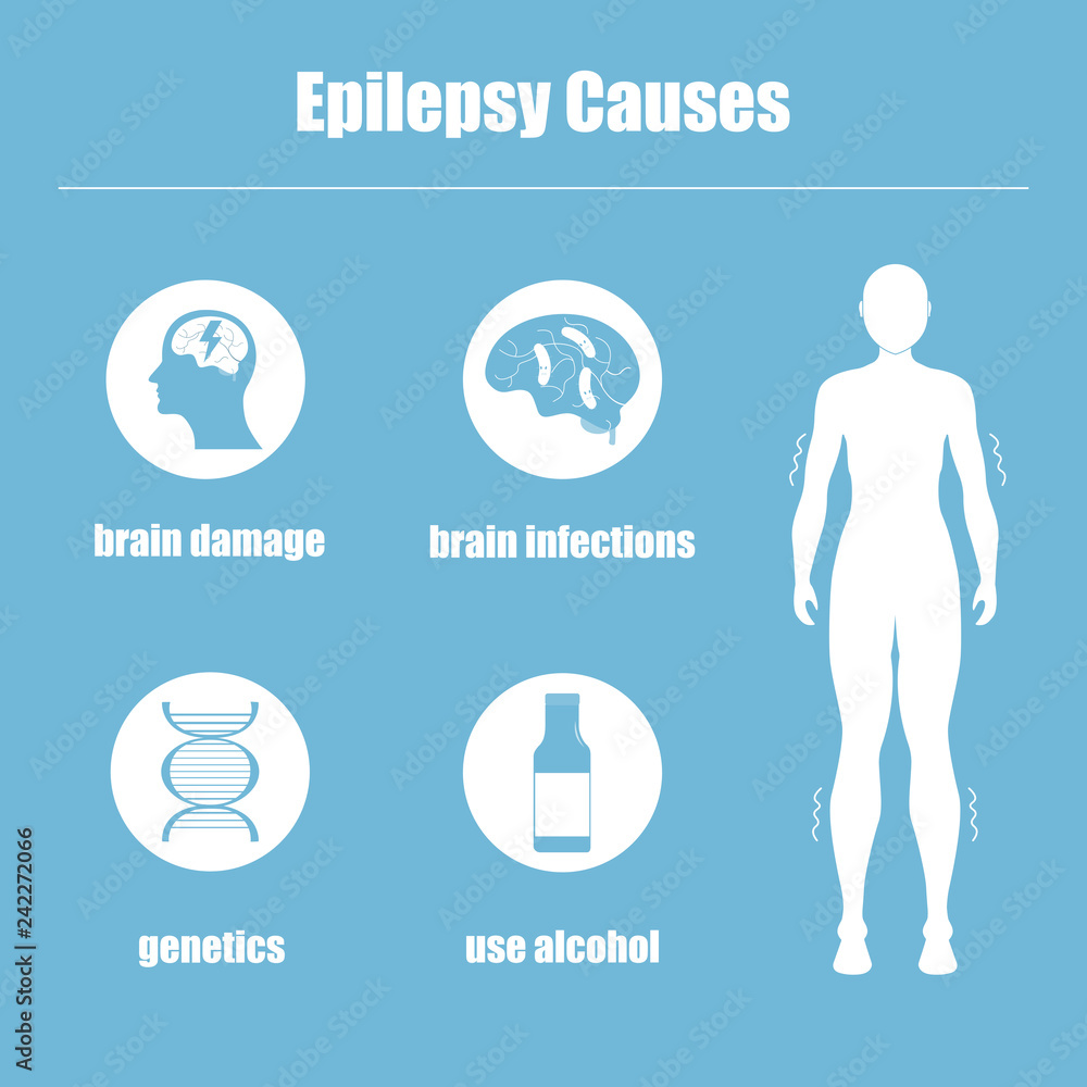 Fototapeta premium Epilepsy causes