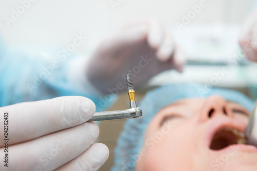 dental implant in the hands of a dentist. An implantation surgery is underway. Titanium implant